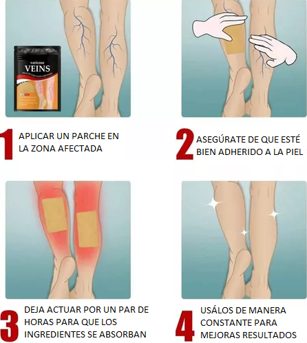 Parches Para Varices 6x1  (72 Unidades)