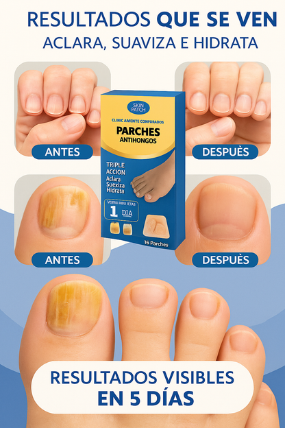 Parches AntiHongo para uñas - Limpieza profunda y visible desde la primera semana