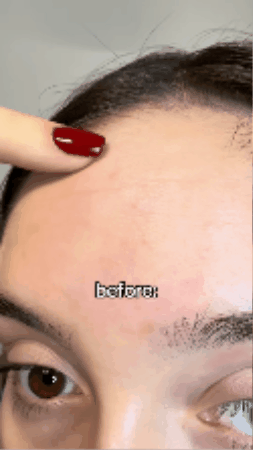 Celimax Retinal Shot Demo 5
